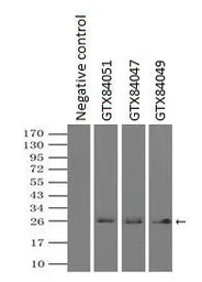 Anti-Neurogenin 1 antibody [9A8] used in Immunoprecipitation (IP). GTX84051