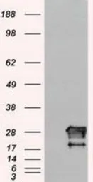 Anti-Neurogenin 1 antibody [9A8] used in Western Blot (WB). GTX84051