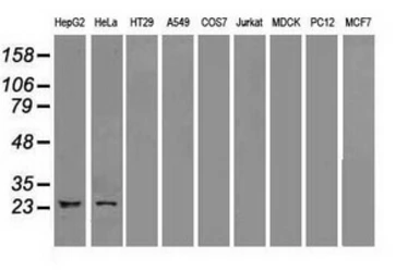 Anti-Neurogenin 1 antibody [9A8] used in Western Blot (WB). GTX84051