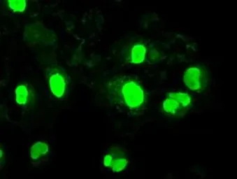 Anti-Neurogenin 1 antibody [9A8] used in Immunocytochemistry/ Immunofluorescence (ICC/IF). GTX84051