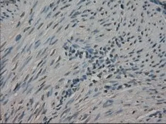 Anti-NEK6 antibody [8G5] used in IHC (Paraffin sections) (IHC-P). GTX84056