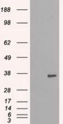 Anti-NEK6 antibody [8G5] used in Western Blot (WB). GTX84056