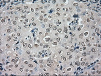 Anti-NEK6 antibody [5D7] used in IHC (Paraffin sections) (IHC-P). GTX84058