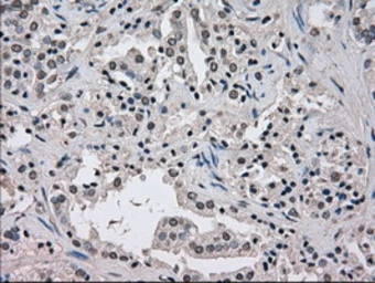 Anti-NEK6 antibody [5D7] used in IHC (Paraffin sections) (IHC-P). GTX84058