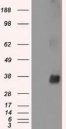 Anti-NEK6 antibody [5D7] used in Western Blot (WB). GTX84058