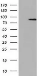 Anti-NEK11 antibody [5E9] used in Western Blot (WB). GTX84061