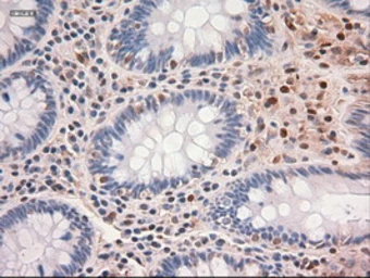 Anti-c-Myc antibody [5G3] used in IHC (Paraffin sections) (IHC-P). GTX84064