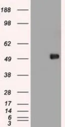 Anti-c-Myc antibody [5G3] used in Western Blot (WB). GTX84064