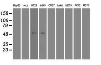 Anti-c-Myc antibody [5G3] used in Western Blot (WB). GTX84064