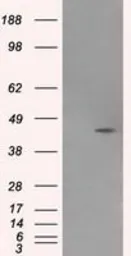 Anti-MTRF1L antibody [1D11] used in Western Blot (WB). GTX84069