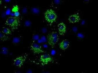 Anti-MTRF1L antibody [1D11] used in Immunocytochemistry/ Immunofluorescence (ICC/IF). GTX84069
