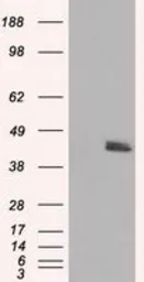 Anti-MTRF1L antibody [1B3] used in Western Blot (WB). GTX84071