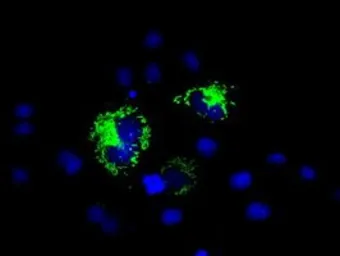 Anti-MTRF1L antibody [1B3] used in Immunocytochemistry/ Immunofluorescence (ICC/IF). GTX84071