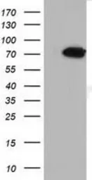 Anti-MTMR14 antibody [6B6] used in Western Blot (WB). GTX84079