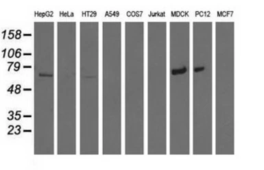 Anti-MTMR14 antibody [6B6] used in Western Blot (WB). GTX84079