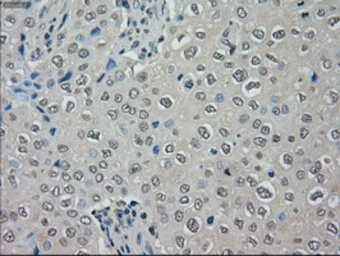 Anti-MRI1 antibody [6G9] used in IHC (Paraffin sections) (IHC-P). GTX84084