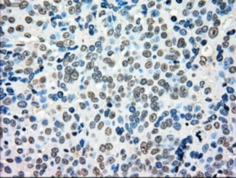 Anti-MRI1 antibody [6G9] used in IHC (Paraffin sections) (IHC-P). GTX84084