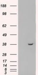 Anti-MRI1 antibody [6G9] used in Western Blot (WB). GTX84084