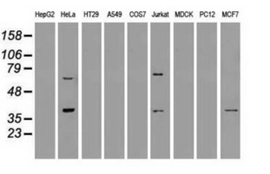 Anti-MRI1 antibody [6G9] used in Western Blot (WB). GTX84084