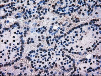 Anti-MRI1 antibody [9H7] used in IHC (Paraffin sections) (IHC-P). GTX84085