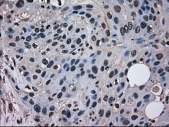 Anti-MRI1 antibody [9H7] used in IHC (Paraffin sections) (IHC-P). GTX84085