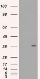 Anti-MRI1 antibody [9H7] used in Western Blot (WB). GTX84085
