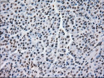 Anti-MRI1 antibody [6A10] used in IHC (Paraffin sections) (IHC-P). GTX84086