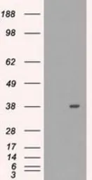 Anti-MRI1 antibody [6A10] used in Western Blot (WB). GTX84086