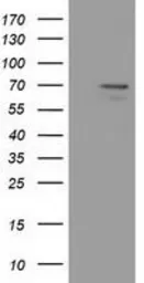 Anti-MPP3 antibody [8F1] used in Western Blot (WB). GTX84090