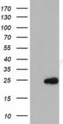 Anti-MOBKL2B antibody [2H8] used in Western Blot (WB). GTX84092