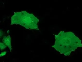 Anti-MOBKL2B antibody [2H8] used in Immunocytochemistry/ Immunofluorescence (ICC/IF). GTX84092