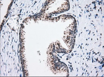 Anti-MOB1B antibody [3G9] used in IHC (Paraffin sections) (IHC-P). GTX84103