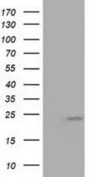Anti-MOB1B antibody [3G9] used in Western Blot (WB). GTX84103
