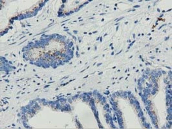 Anti-MOB1B antibody [1H2] used in IHC (Paraffin sections) (IHC-P). GTX84105