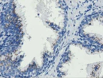 Anti-MOB1B antibody [1H2] used in IHC (Paraffin sections) (IHC-P). GTX84105