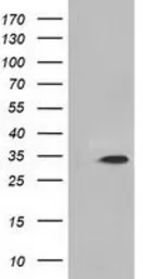 Anti-MIOX antibody [1C5] used in Western Blot (WB). GTX84112