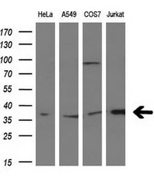 Anti-MCL1 antibody [2E11] used in Western Blot (WB). GTX84135