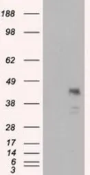 Anti-MCL1 antibody [2E11] used in Western Blot (WB). GTX84135