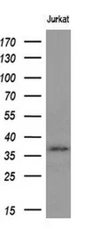 Anti-MCL1 antibody [10F6] used in Western Blot (WB). GTX84140