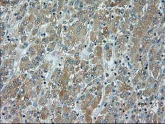 Anti-JNK1 antibody [4E3] used in IHC (Paraffin sections) (IHC-P). GTX84144