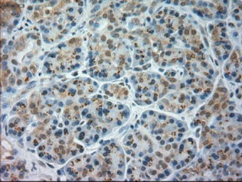 Anti-JNK1 antibody [4E3] used in IHC (Paraffin sections) (IHC-P). GTX84144