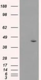 Anti-JNK1 antibody [2C6] used in Western Blot (WB). GTX84145