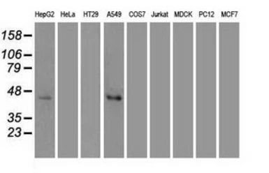 Anti-JNK1 antibody [2C6] used in Western Blot (WB). GTX84145