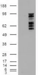 Anti-ERK3 antibody [1A9] used in Western Blot (WB). GTX84147