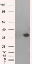 Anti-p38 beta antibody [1C2] used in Western Blot (WB). GTX84149
