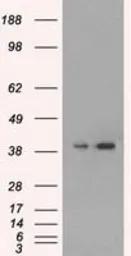 Anti-ERK2 antibody [4C2] used in Western Blot (WB). GTX84151