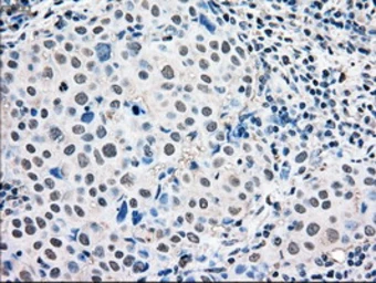 Anti-ERK2 antibody [6F8] used in IHC (Paraffin sections) (IHC-P). GTX84154