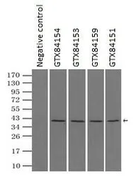 Anti-ERK2 antibody [6F8] used in Immunoprecipitation (IP). GTX84154