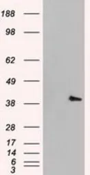 Anti-ERK2 antibody [6F8] used in Western Blot (WB). GTX84154