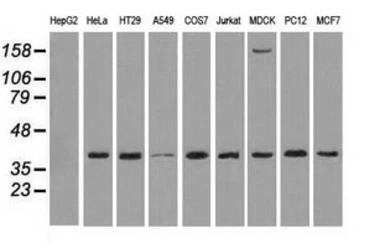Anti-ERK2 antibody [6F8] used in Western Blot (WB). GTX84154